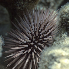 In Hotter Climate, 'Zombie' Urchins Are Winning And Kelp Forests Are Losing